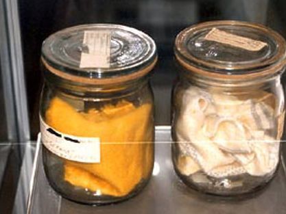 Ausstellungsexponate: Von der Stasi gesammelte Körpergerüche - aufbewahrt in Einweckgläsern